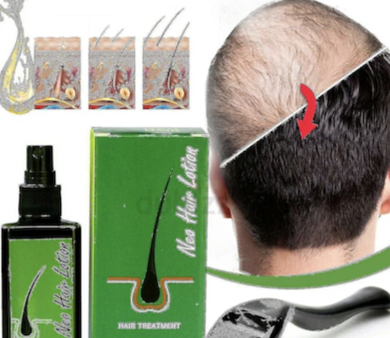 Green Wealth Neo Hair Lotion, 120 ML, stimulate Hair Growth, Suitable For Both Men and Women